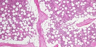 Cognition in Parkinson’s Disease