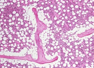 Cognition in Parkinson’s Disease