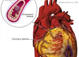 Coronary Artery