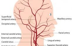 Giant Cell Arteritis