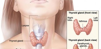 hypothyroidism