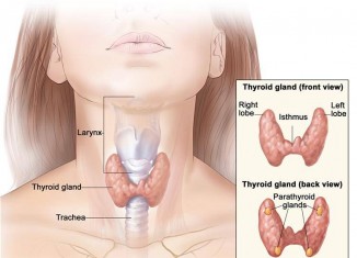 hypothyroidism