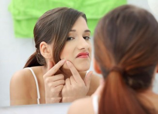 How to Get Rid of Acne