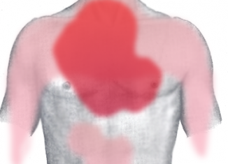 heartburn