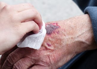 Wound Healing with Cold Plasma Therapy