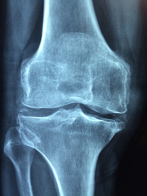 knee